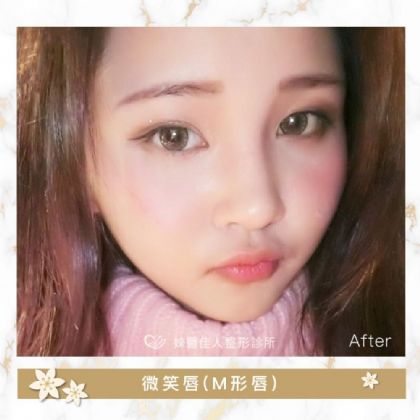 嘴型調整